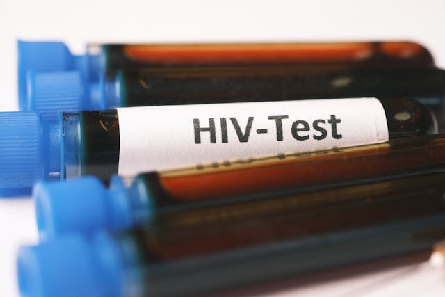 krvny test HIV
